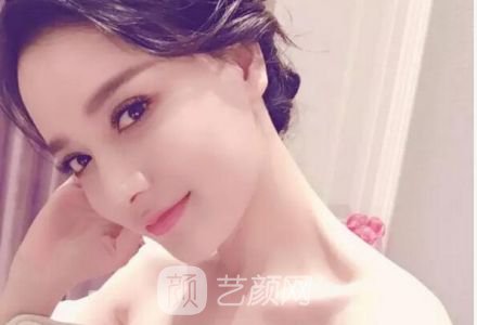 鼻整形手术后注意事项有哪些？