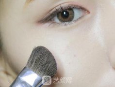 外眼角提升能管多久?