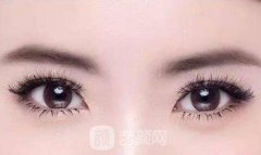 全切双眼皮失败修复过程是怎样的