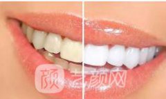 牙齿3d瓷贴面该怎么护理了？