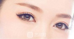 什么是3d微创双眼皮？果怎么样？