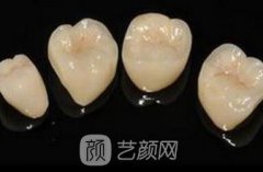 上海3d烤瓷牙冠价格是多少呢?