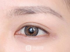 玻尿酸丰卧蚕几天定形?