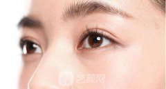 光子去黑眼圈多少钱？价格贵不贵？
