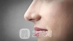 厦门玻尿酸隆鼻多少钱？