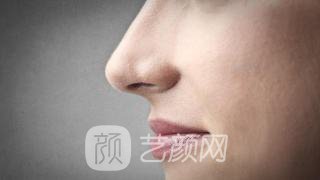 厦门玻尿酸隆鼻多少钱?