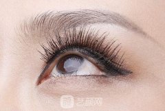 泪腺脱垂手术多久恢复？术后注意事项有哪些？