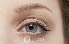 激光去除黑眼圈要多少次才有？