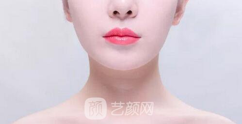 注射丰唇材料有哪些?什么注射丰唇材料比较好?