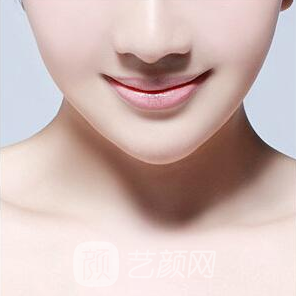 下颌角切除手术后多久能消肿?