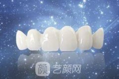 牙齿3d美容冠价格?3d美容冠多少钱?