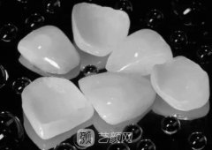 3d瓷贴面多少钱?3d瓷贴面价格?