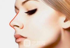 鼻尖缺损修复多少钱？鼻尖缺损修复价格贵不贵？