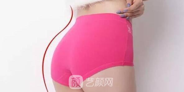 【巴西提臀术的价格是多少?巴西提臀术的风险和副作用？】