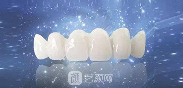 【3d美冠牙有副作用吗?3d美冠牙的副作用有哪些?】