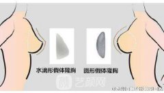 韩式吸脂隆胸的费用多少？韩式吸脂隆胸费用的影响因素？
