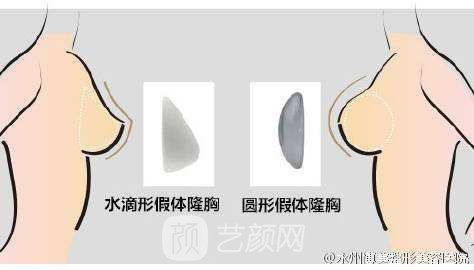 【韩式吸脂隆胸的费用多少？韩式吸脂隆胸费用的影响因素？】