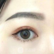 厦门做3d双眼皮多少钱啊，影响价格的因素