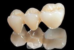 钯金烤瓷牙费用多少?钯金烤瓷牙费用影响因素是什么?
