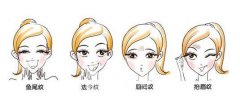 生物素除皱价格多少?生物素除皱价格影响因素都有什么呢