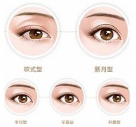 吸雕双眼皮价格多少?吸雕双眼皮价格影响因素是什么?