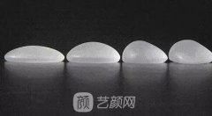 上海麦格假体的价格是多少，麦格假体材料贵不贵？
