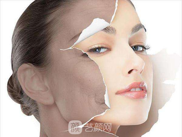 光子嫩肤有哪些果？