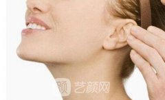 自体脂肪丰耳垂价格多少?自体脂肪丰耳垂价格影响因素