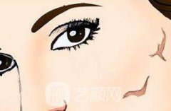 像素激光祛疤价格多少?像素激光祛疤价格影响因素是什么?