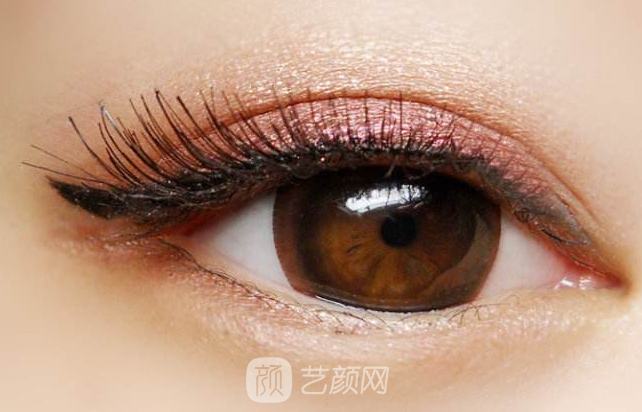 开眼角有什么后遗症吗?