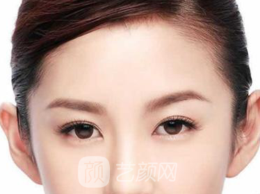 开眼角有什么优点和缺点?