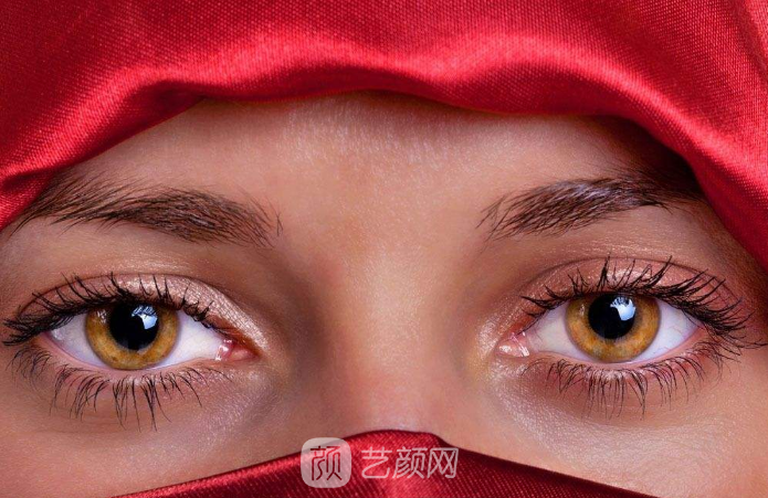 适合开眼角的人群有哪些?