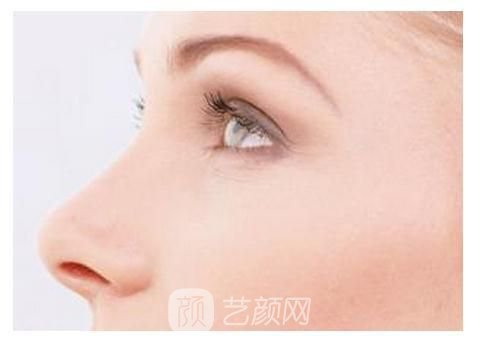膨体隆鼻术后注意事项有哪些？