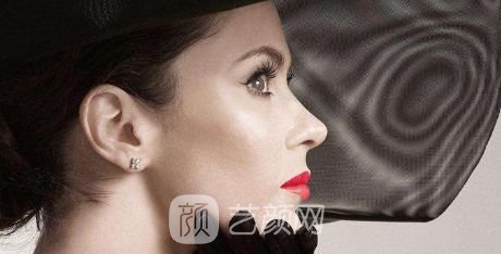 自体脂肪隆鼻有哪些优势？