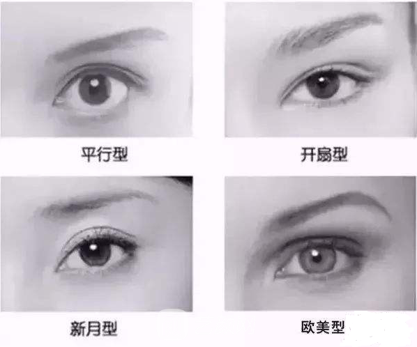 双眼皮的种类有哪些?