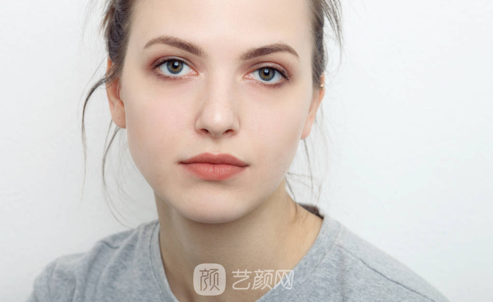 全切双眼皮的注意事项有哪些?