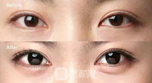 丰卧蚕果好吗？