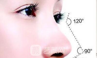 重庆微晶瓷隆鼻价格多少?微晶瓷隆鼻价格影响因素~