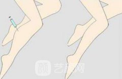 天津打要多少钱？