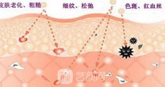 北京e光嫩肤多少钱?e光嫩肤价格有哪些影响因素?
