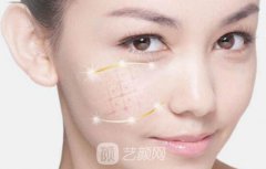 热玛吉除皱价格多少?热玛吉除皱价格有哪些影响因素?