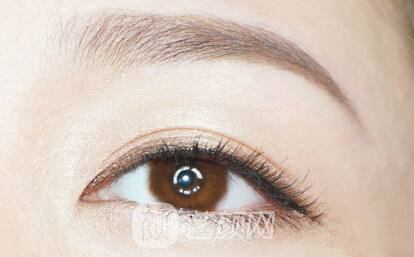 激光洗眉有哪些优势？