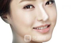 高泰克斯隆鼻价格多少?高泰克斯隆鼻价格影响因素有哪些?