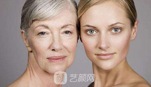 光子嫩肤术前需要做什么准备?术后又该怎么护理?