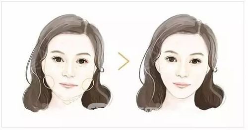 磨骨整形有哪些优势？