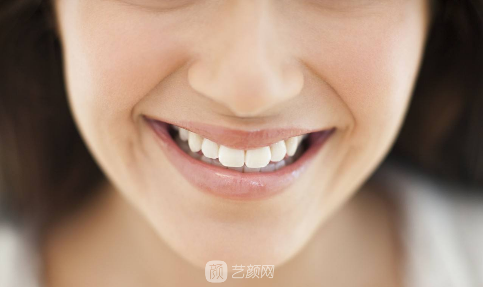 在成都做自体脂肪丰下巴多少钱？