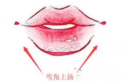 上海嘴角上扬术费用大概要多少