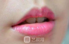 武汉漂唇术多少钱