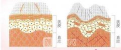 重庆胶原蛋白丰额头多少钱?