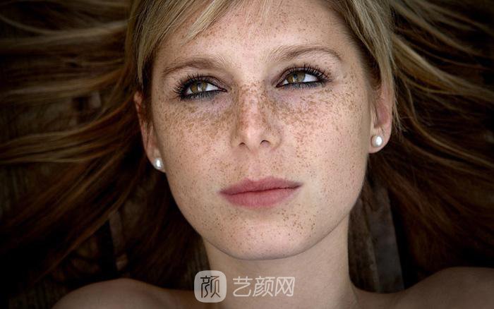 怎样去蝴蝶斑比较好?